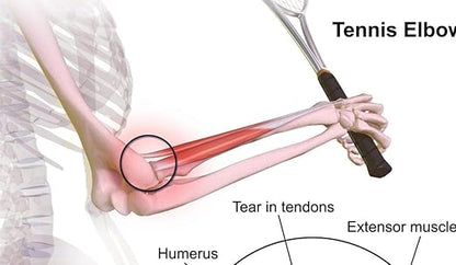 Life Care Tennis Golf Elbow Wrap